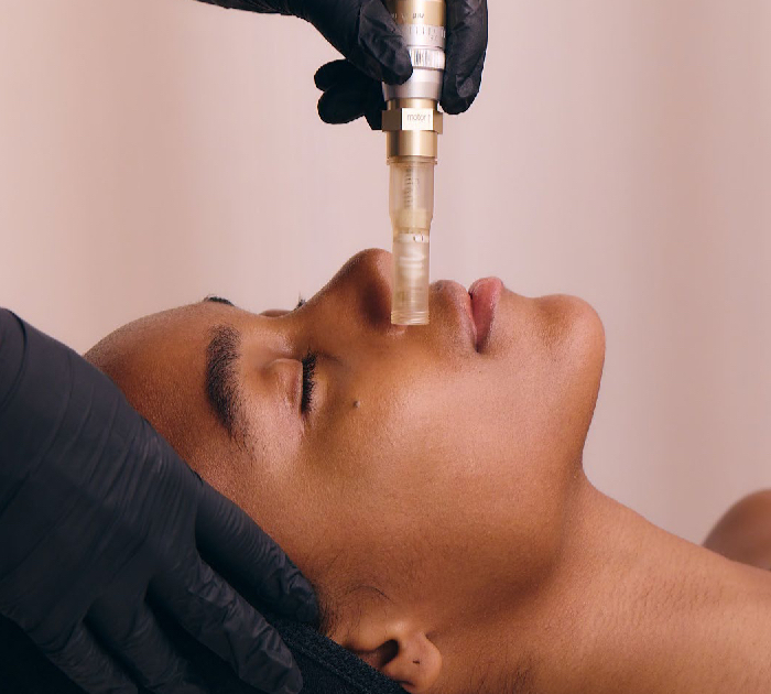 Nanoneedling vs Microneedling: